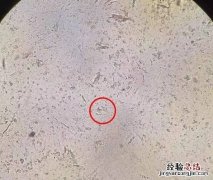 蟑螂怕冷吗会不会冻死