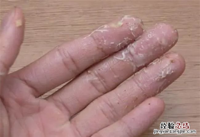 菠萝蜜的蜜怎么洗掉,菠萝蜜的胶粘在手上怎么洗掉