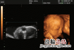 孕20周胎儿多大正常 20周的胎儿有多大