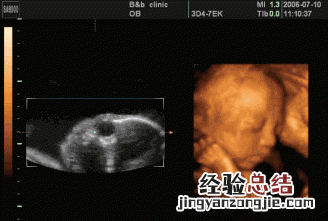 孕20周胎儿多大正常 20周的胎儿有多大