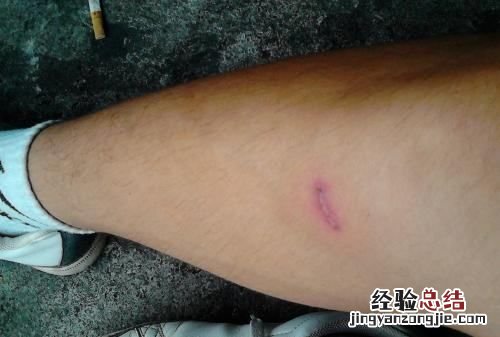 蟑螂会咬人，蟑螂吃肉会咬人