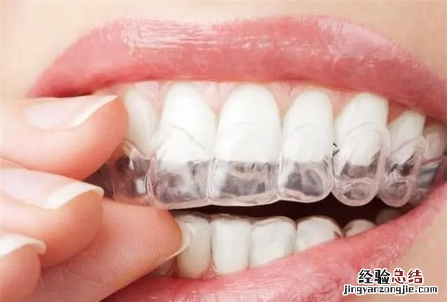 带牙套痛不痛