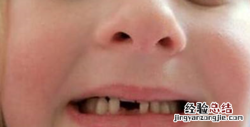 牙烂到什么程度要根管治疗