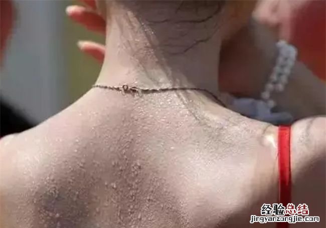 女性夏天出汗多正常