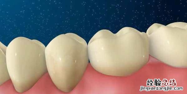 医生不建议清理牙结石有什么说法