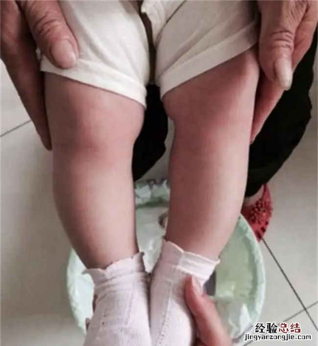 为什么不要给新生儿捆腿