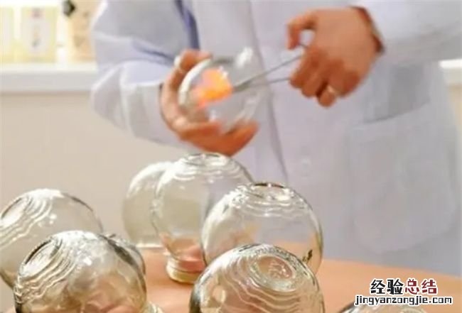 拔罐时哪些事项要注意