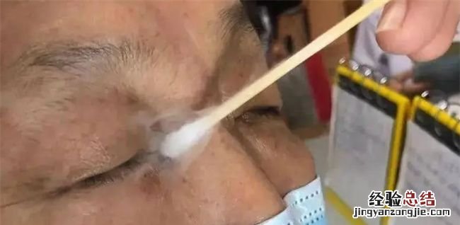 鱼痣怎么去除小妙招,鱼痣的去除方法有哪些