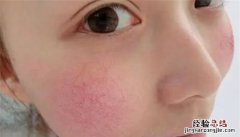 早c晚a是什么作用，早c晚a为什么越用越黑