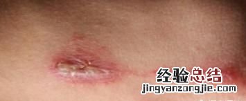 大蚰蜒有毒吗 蚰蜒一般有毒吗