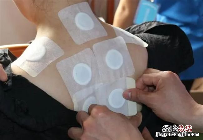 三伏贴一个疗程贴几天，三伏贴贴几次为一个疗程