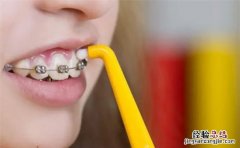 戴完牙套饭后必须刷牙，牙齿矫正期间刷牙的正确方法