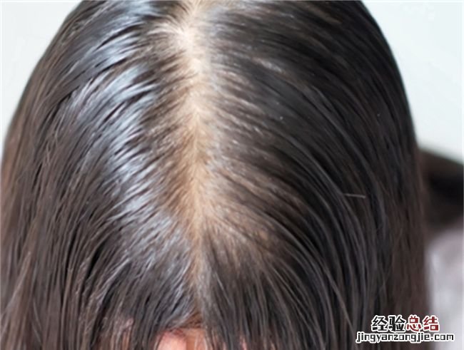爽身粉擦头发有危害,爽身粉去头油有哪些害处呢