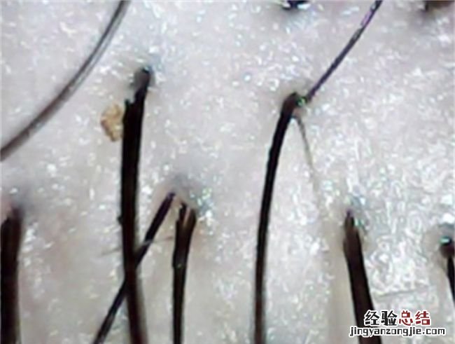 爽身粉擦头发有危害,爽身粉去头油有哪些害处呢