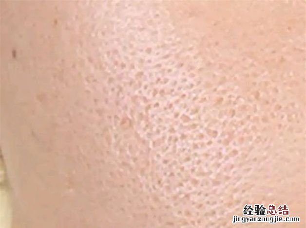 为什么医生不建议涂防晒霜