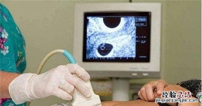 宫外孕是怎么引起的,什么原因会引起宫外孕