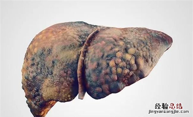 这些红点的出现需要立即就医,身上出现很多小红点是怎么回事