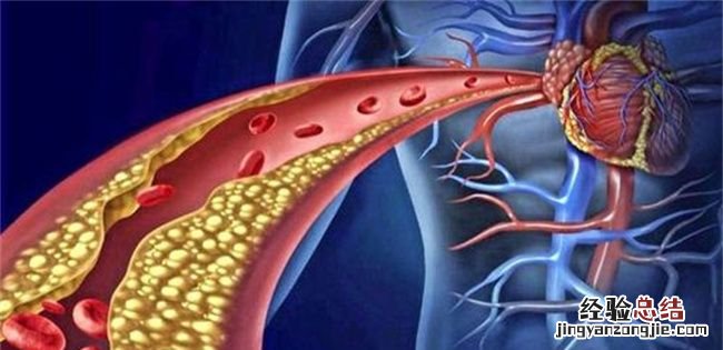 胆固醇愈低真的愈好，胆固醇越低越好的说法是不完全正确的