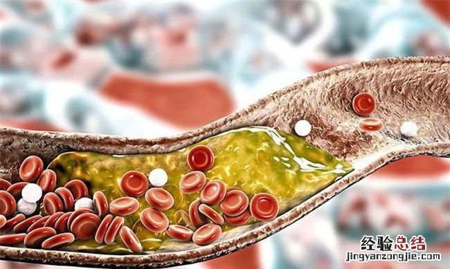 胆固醇愈低真的愈好，胆固醇越低越好的说法是不完全正确的