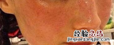 用白醋泡脚有什么好处 用白醋洗脸有什么好处