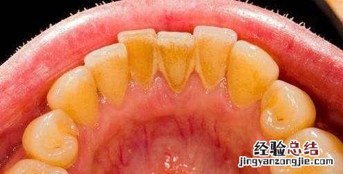 如何正确刷牙,如何正确刷牙的方法