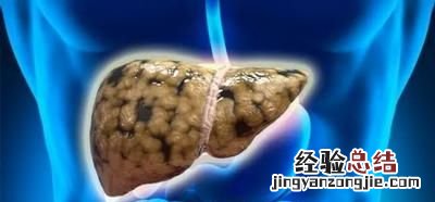 女性养肝茶有哪些，肝脏不好的人是不是脸色发黄