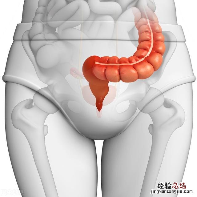 直肠癌的7个早期症状有什么表现 直肠癌是怎么引起的如何预防直肠癌