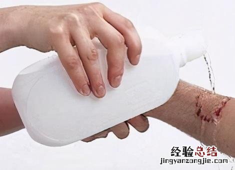 被自己家狗抓伤了需要打疫苗吗 被狗狗抓伤怎么办