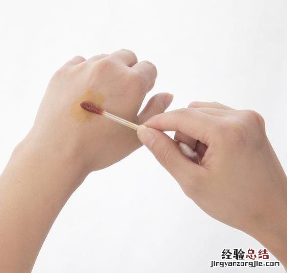 被自己家狗抓伤了需要打疫苗吗 被狗狗抓伤怎么办