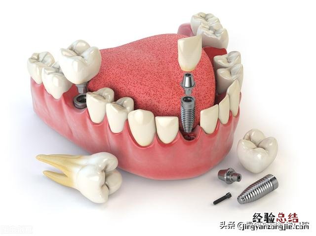 牙缝越来越大是什么原因引起的 牙齿之间的缝越来越宽怎么办