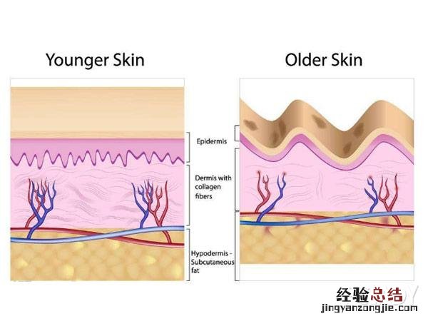 颈纹消除的最好的方法和技巧 怎么去除颈纹最有效的方法