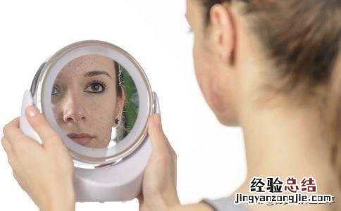 肝火旺盛容易长痘要怎么调节 肝火旺引起的长痘怎么办
