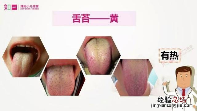 教你一招辨别孩子体质 舌苔厚白是怎么回事