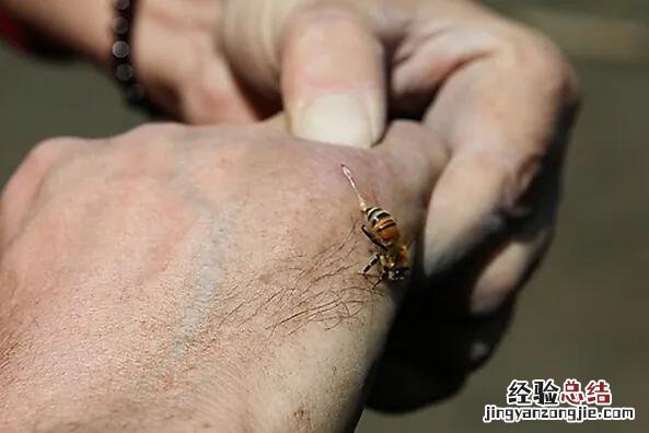 被蜜蜂蛰了如何快速的处理 手被蜂子蛰了怎么消肿止痒