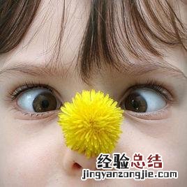 婴儿斗鸡眼的解决方法 婴儿对眼怎么办
