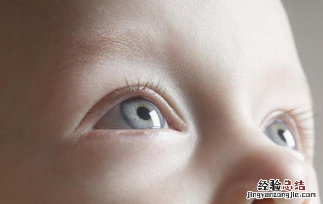 婴儿斗鸡眼的解决方法 婴儿对眼怎么办