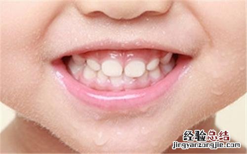 宝宝长牙发烧解决方法 宝宝长牙发烧怎么办