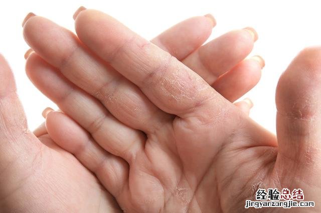 按压这里就能轻松解决 脸上出油太多怎么解决