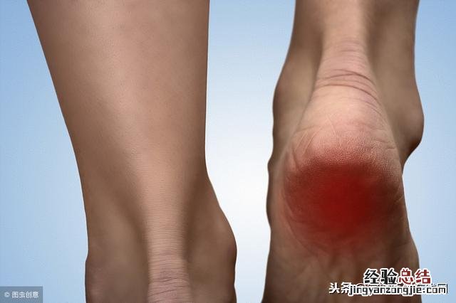 脚后跟开裂最简单的修复方法 脚裂口怎么办脚后跟裂口怎么办