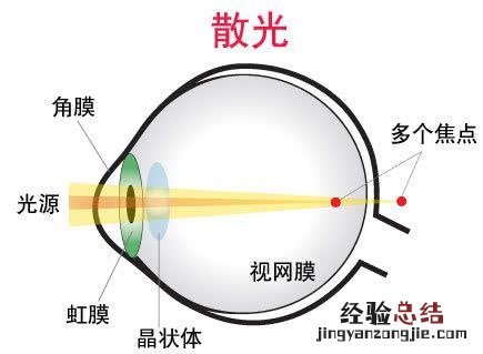 如何给自己做个测试呢 散光是怎么回事 为什么会造成散光