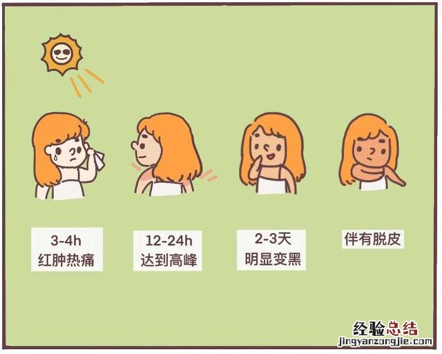 皮肤晒伤发红怎么办小妙招 晒伤了怎么办通红疼痛