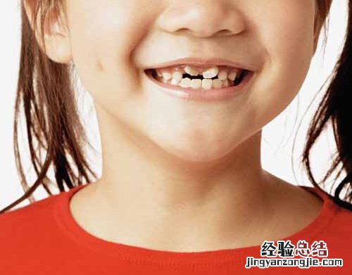 儿童换牙期间吃什么好 儿童换牙期间吃什么好些