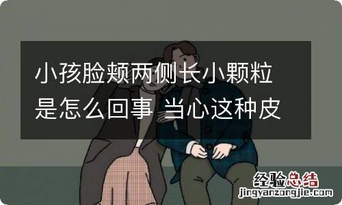 小孩脸颊两侧长小颗粒是怎么回事 当心这种皮肤病来袭