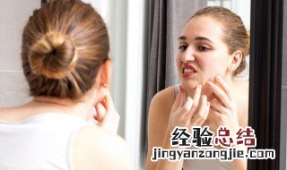 长痘为什么不能喝牛奶 长痘不能喝牛奶吗