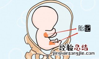 胎记是怎样造成的 如何预防