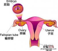 什么是宫外孕症状早期 什么是宫外孕