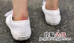 脚跟被鞋磨破了怎么办 脚跟被鞋磨破了怎么办图片