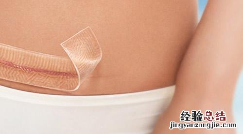 剖腹产伤口怎么护理不留疤 剖腹产伤口怎么不留疤