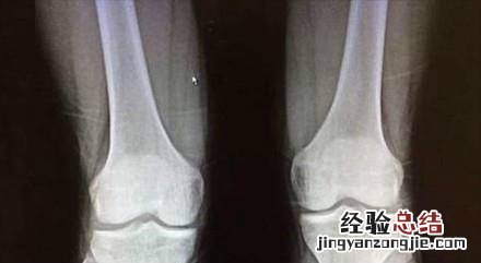 打篮球能长高吗