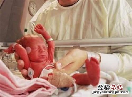 羊水早破对胎儿有影响吗 羊水早破对胎儿有什么影响